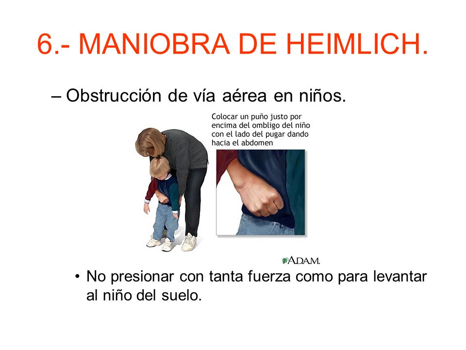 6.- MANIOBRA DE HEIMLICH. Obstrucción de vía aérea en niños.