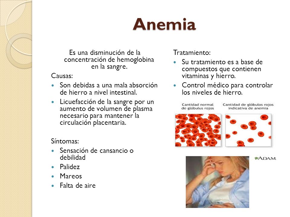 Es una disminución de la concentración de hemoglobina en la sangre.