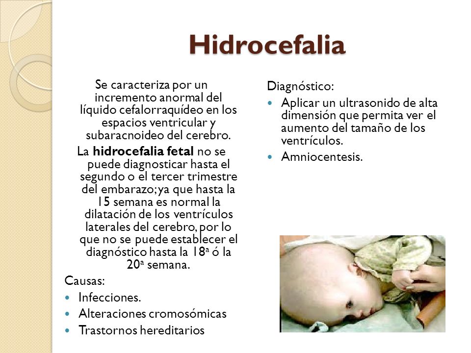Hidrocefalia Se caracteriza por un incremento anormal del líquido cefalorraquídeo en los espacios ventricular y subaracnoideo del cerebro.
