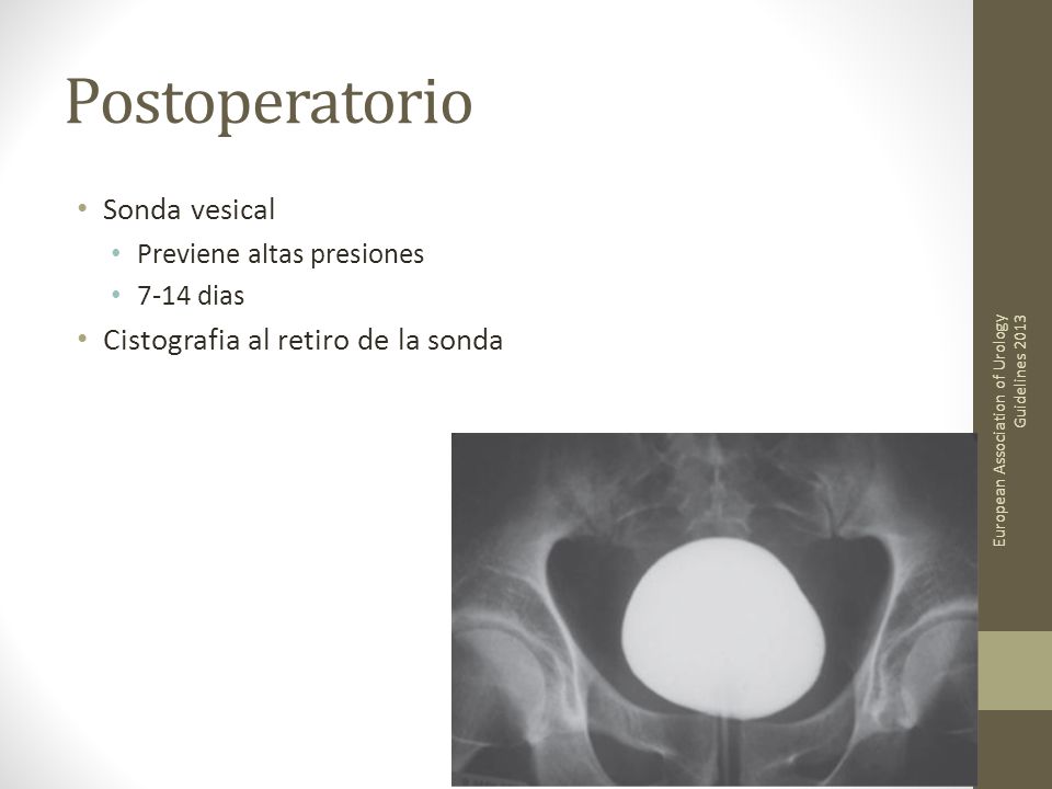 Postoperatorio Sonda vesical Cistografia al retiro de la sonda