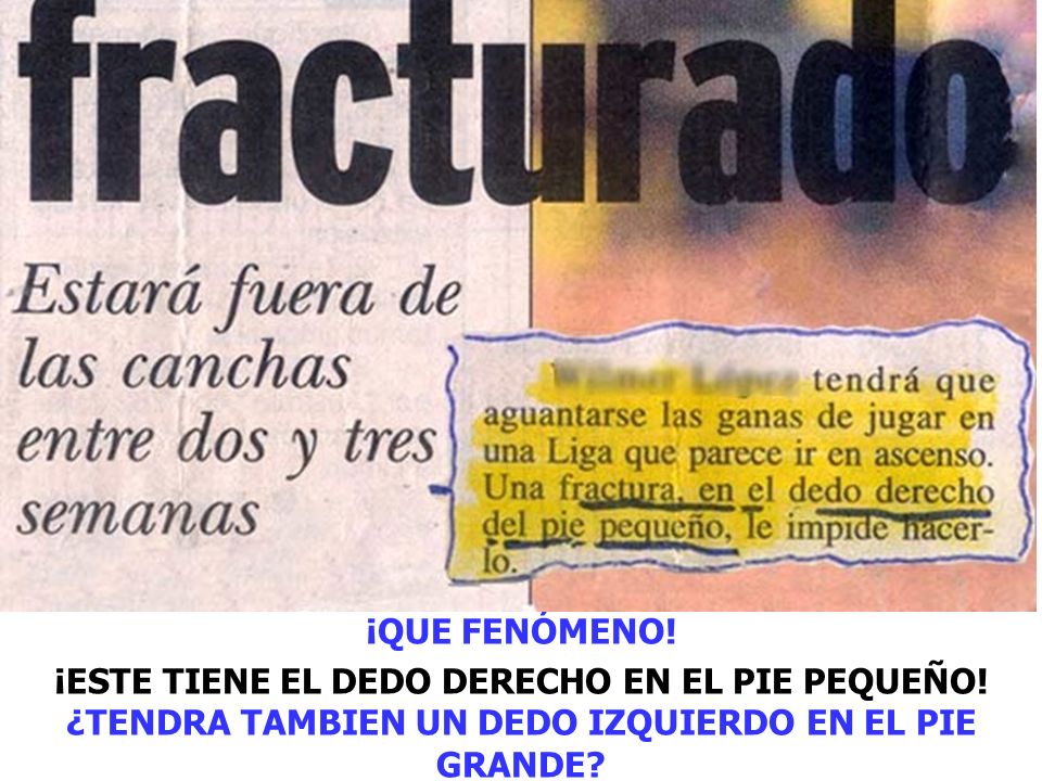 ¡QUE FENÓMENO. ¡ESTE TIENE EL DEDO DERECHO EN EL PIE PEQUEÑO.