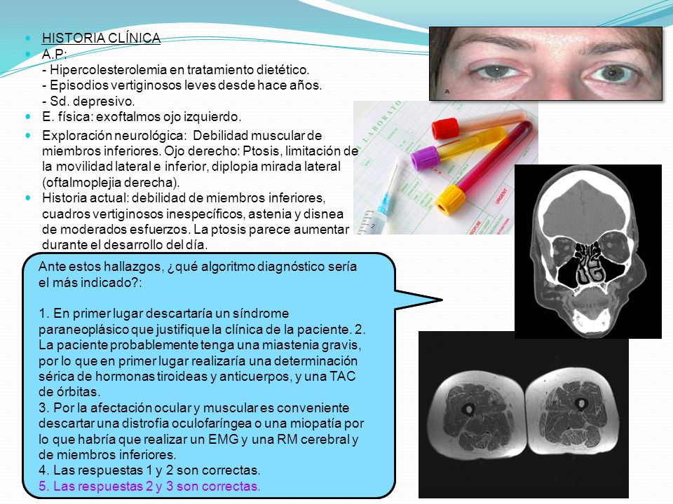 HISTORIA CLÍNICA A.P: - Hipercolesterolemia en tratamiento dietético. - Episodios vertiginosos leves desde hace años. - Sd. depresivo.