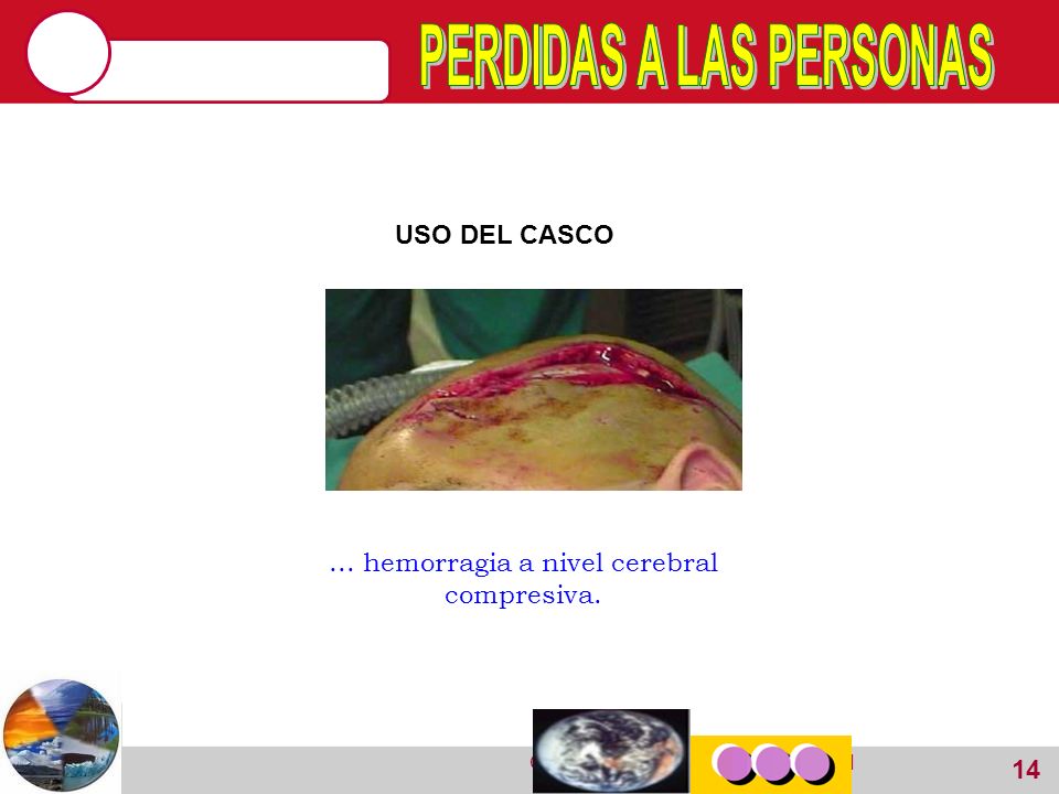 PERDIDAS A LAS PERSONAS