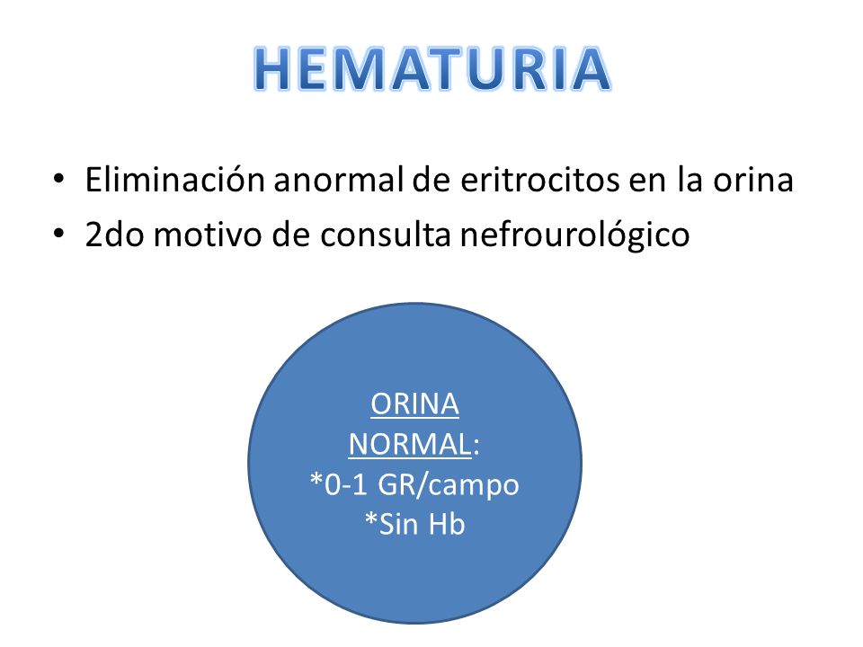 HEMATURIA Eliminación anormal de eritrocitos en la orina