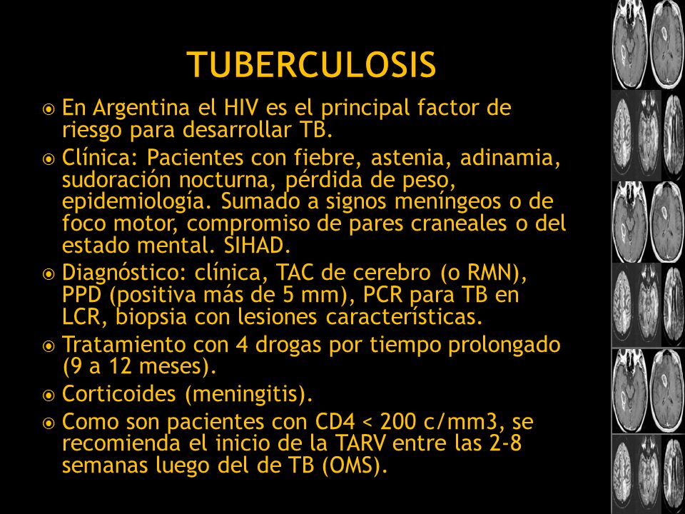 Tuberculosis En Argentina el HIV es el principal factor de riesgo para desarrollar TB.