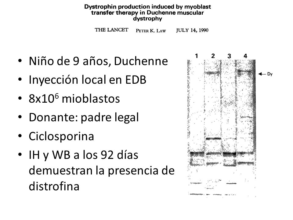 Niño de 9 años, Duchenne Inyección local en EDB. 8x106 mioblastos. Donante: padre legal. Ciclosporina.