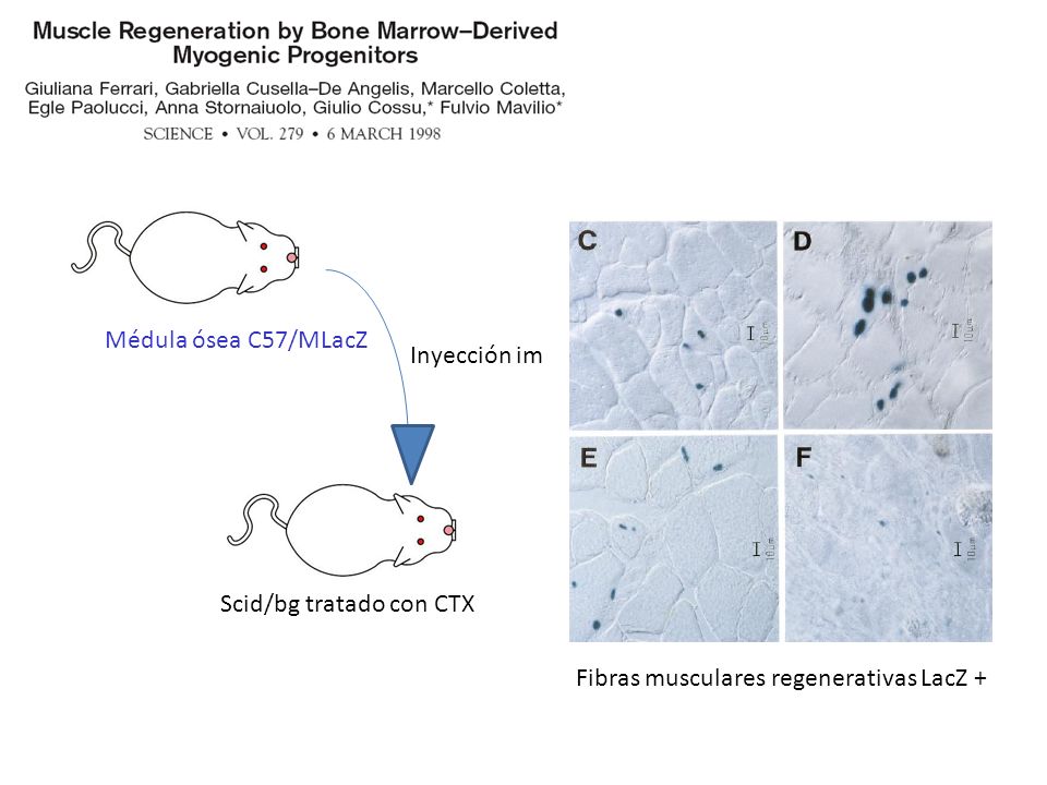 Médula ósea C57/MLacZ Inyección im Scid/bg tratado con CTX Fibras musculares regenerativas LacZ +
