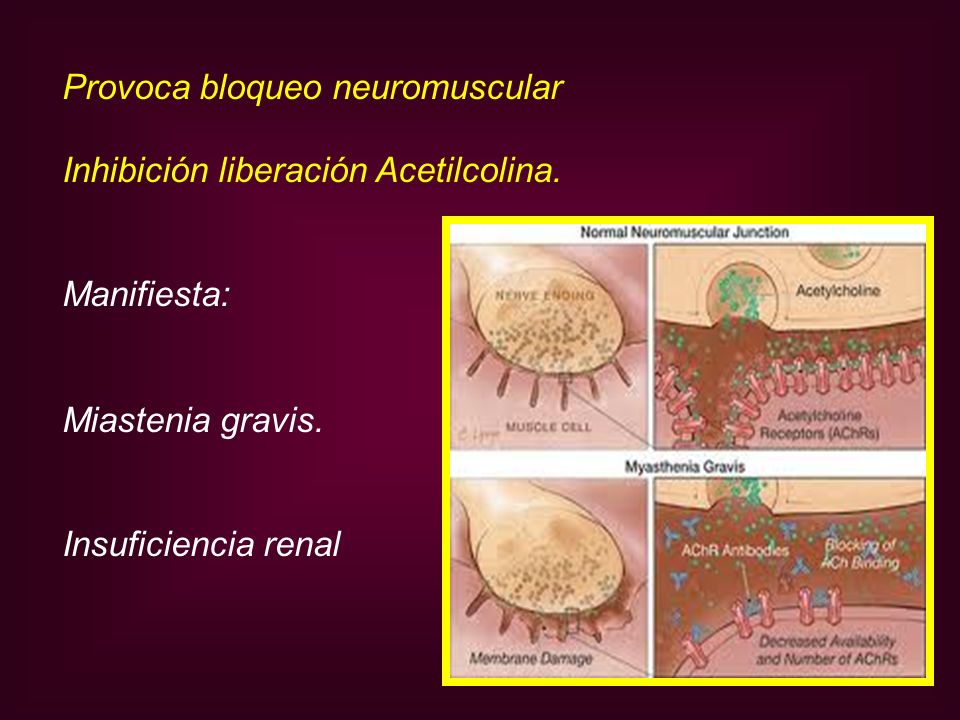 Provoca bloqueo neuromuscular