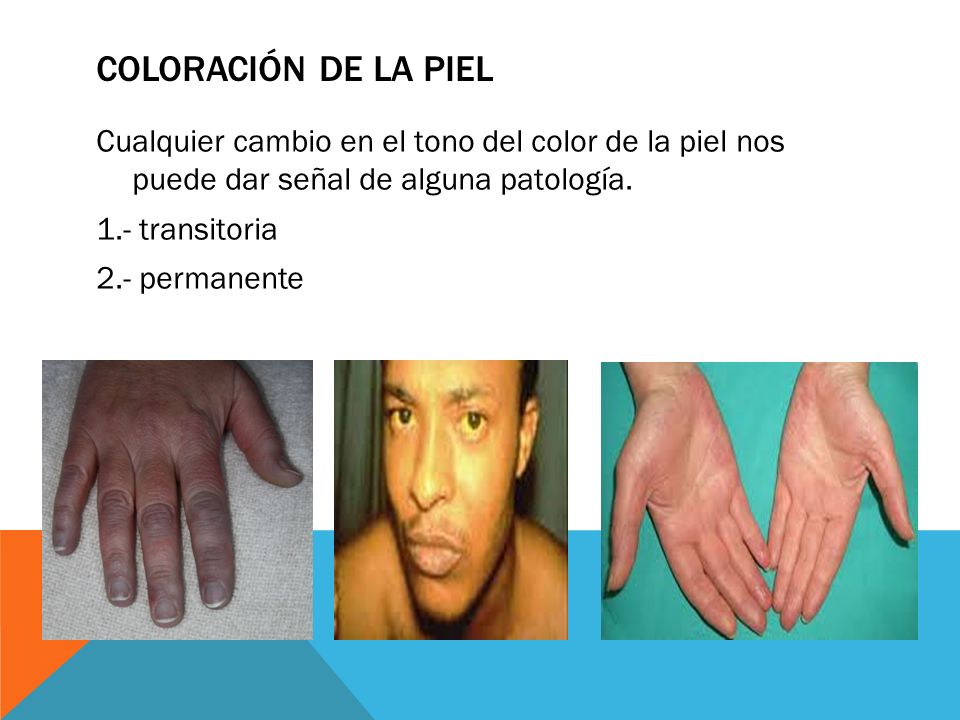 Coloración de la piel Cualquier cambio en el tono del color de la piel nos puede dar señal de alguna patología.