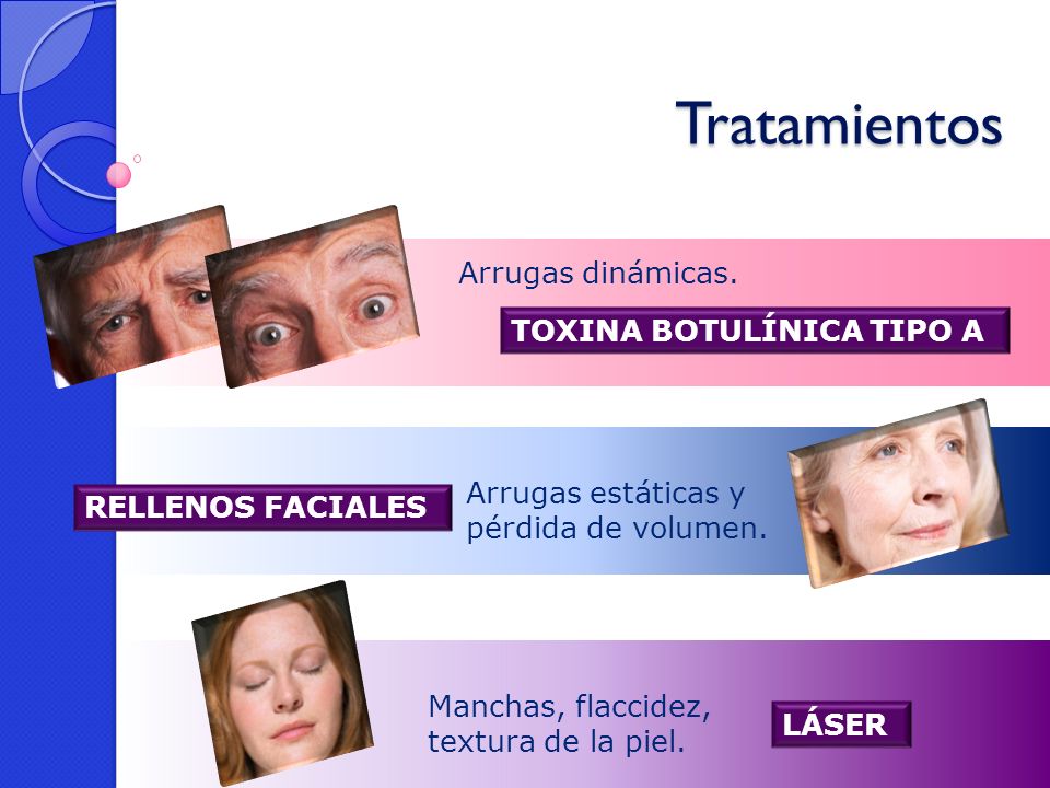 Tratamientos Arrugas dinámicas. TOXINA BOTULÍNICA TIPO A
