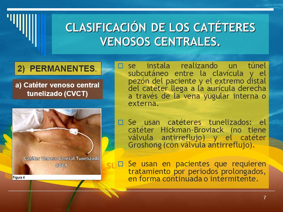 Manejo de Enfermería: CATETER VENOSO CENTRAL. - ppt descargar