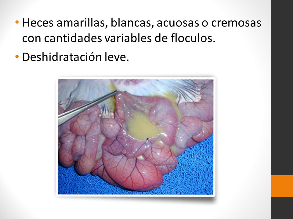 Heces amarillas, blancas, acuosas o cremosas con cantidades variables de floculos.