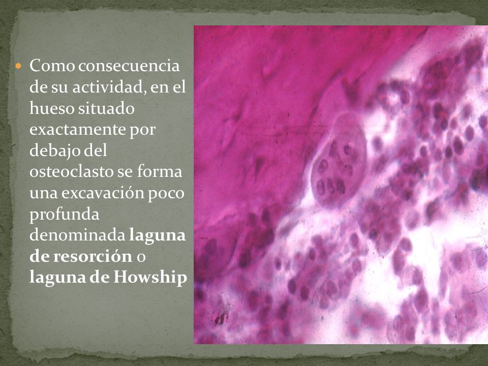 Como consecuencia de su actividad, en el hueso situado exactamente por debajo del osteoclasto se forma una excavación poco profunda denominada laguna de resorción o laguna de Howship