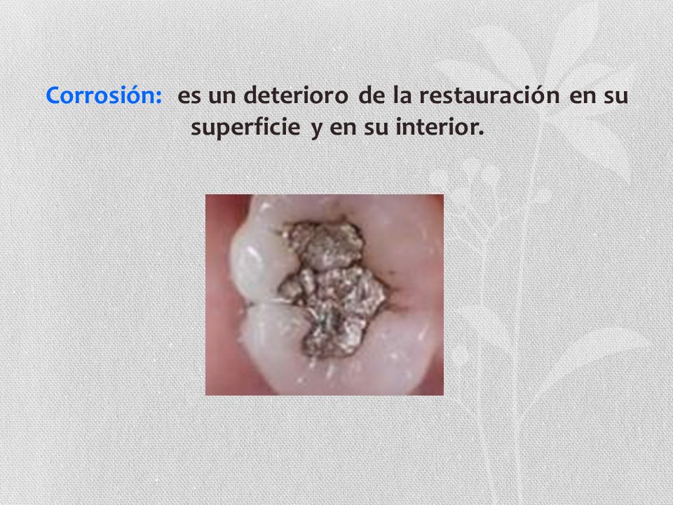 Corrosión: es un deterioro de la restauración en su superficie y en su interior.