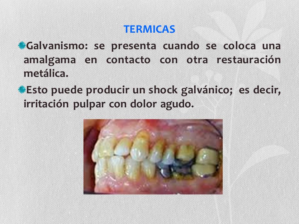 TERMICAS Galvanismo: se presenta cuando se coloca una amalgama en contacto con otra restauración metálica.