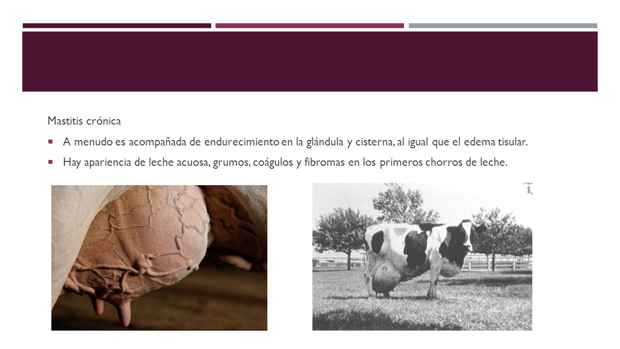 Mastitis crónica A menudo es acompañada de endurecimiento en la glándula y cisterna, al igual que el edema tisular.