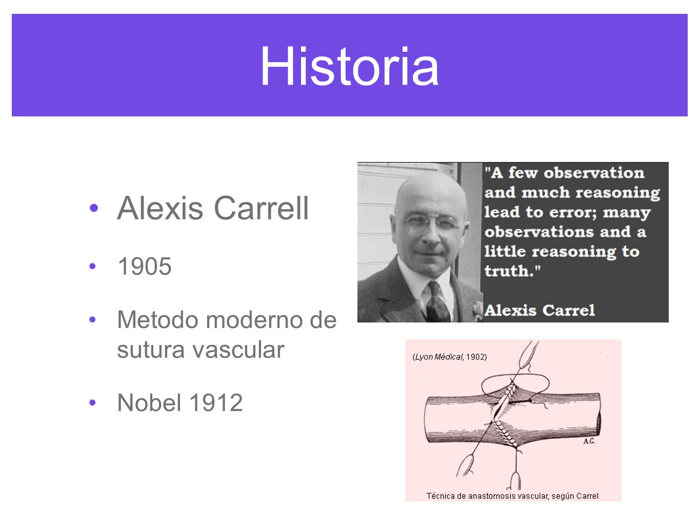 Historia Alexis Carrell 1905 Metodo moderno de sutura vascular