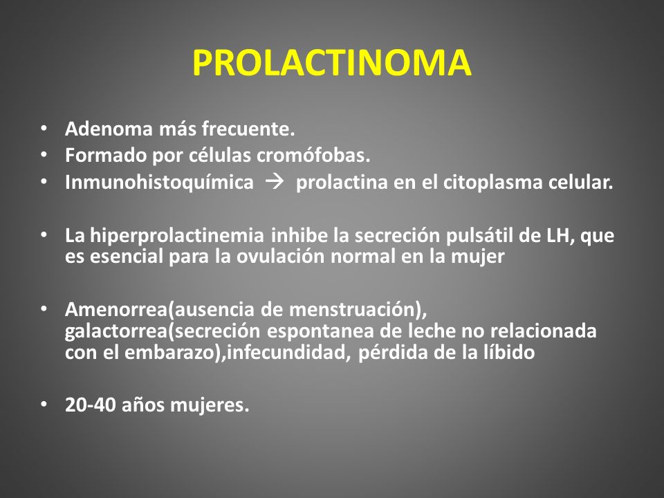PROLACTINOMA Adenoma más frecuente. Formado por células cromófobas.