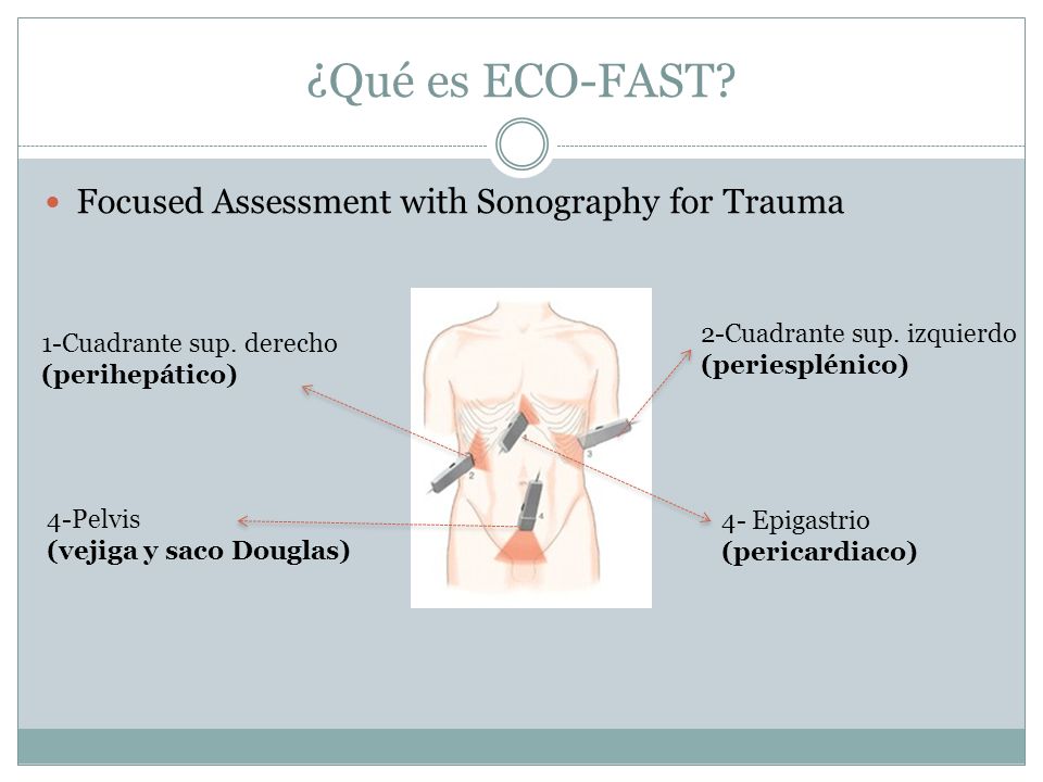¿Qué es ECO-FAST Focused Assessment with Sonography for Trauma