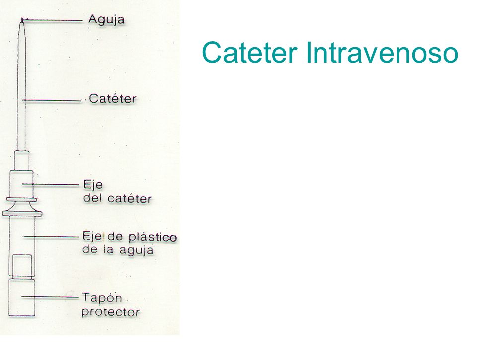 Cateter Intravenoso