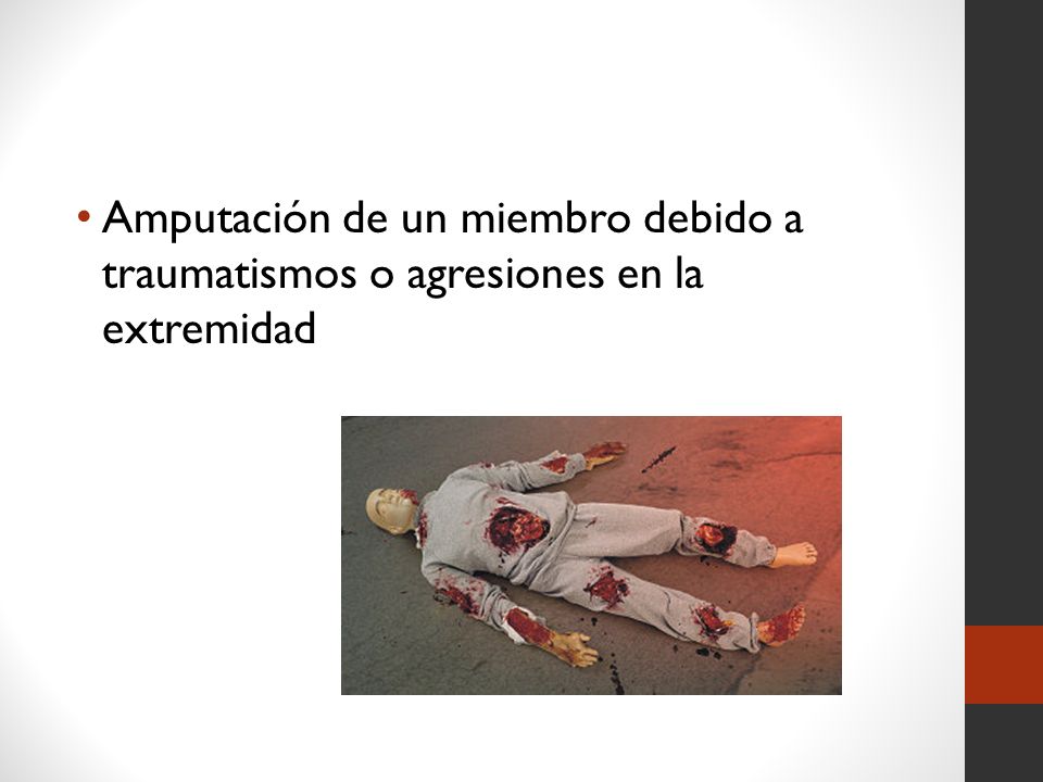Amputación de un miembro debido a traumatismos o agresiones en la extremidad