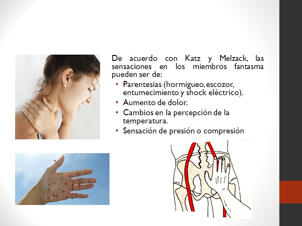De acuerdo con Katz y Melzack, las sensaciones en los miembros fantasma pueden ser de: