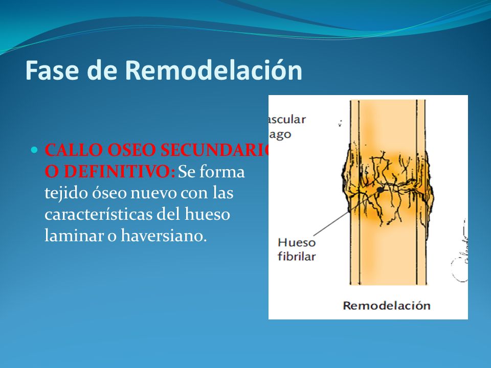 Fase de Remodelación CALLO OSEO SECUNDARIO O DEFINITIVO: Se forma tejido óseo nuevo con las características del hueso laminar o haversiano.