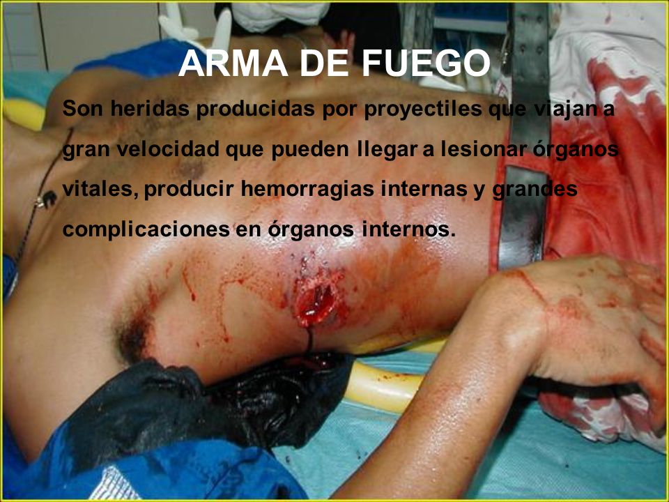 ARMA DE FUEGO
