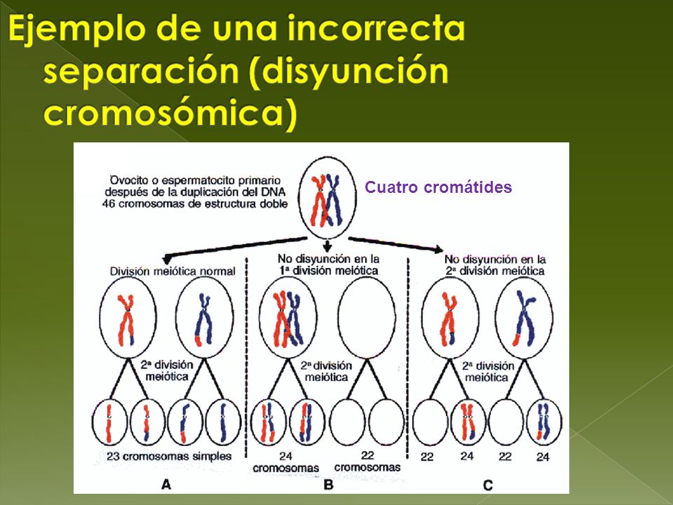 Ejemplo de una incorrecta separación (disyunción cromosómica)