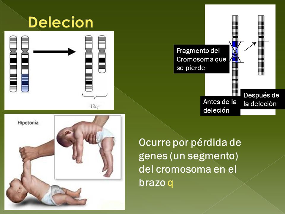 Delecion Fragmento del. Cromosoma que se pierde. Después de la deleción. Antes de la deleción.