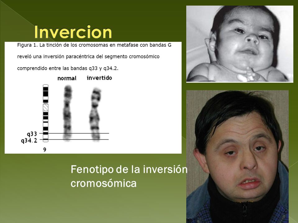 Invercion Fenotipo de la inversión cromosómica