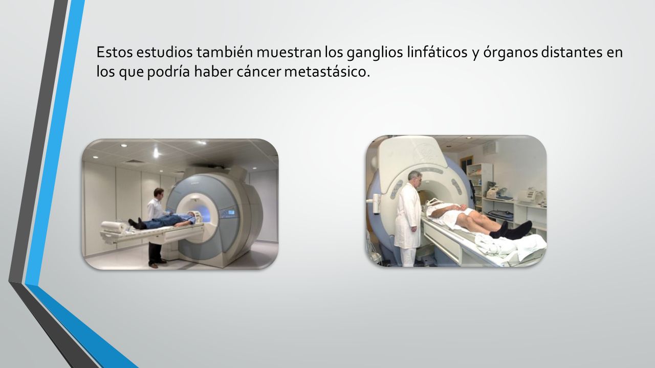 Estos estudios también muestran los ganglios linfáticos y órganos distantes en los que podría haber cáncer metastásico.