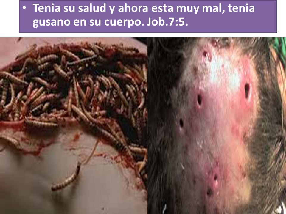 Tenia su salud y ahora esta muy mal, tenia gusano en su cuerpo. Job