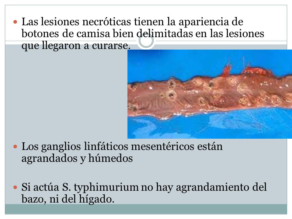 Las lesiones necróticas tienen la apariencia de botones de camisa bien delimitadas en las lesiones que llegaron a curarse.