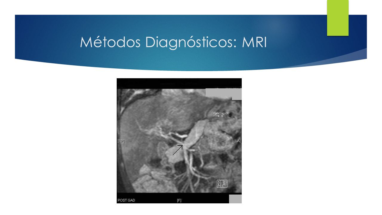 Métodos Diagnósticos: MRI