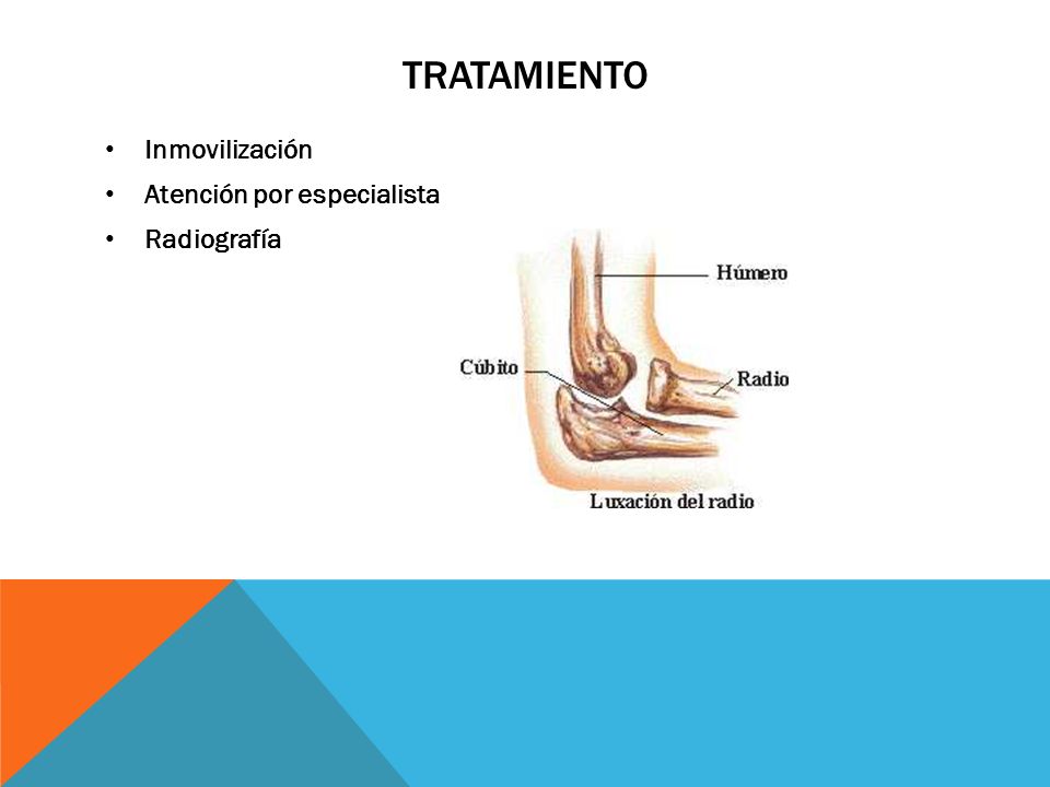 TRATAMIENTO Inmovilización Atención por especialista Radiografía