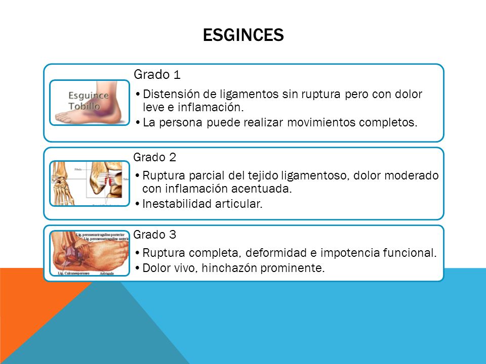 ESGINCES Grado 1. Distensión de ligamentos sin ruptura pero con dolor leve e inflamación. La persona puede realizar movimientos completos.
