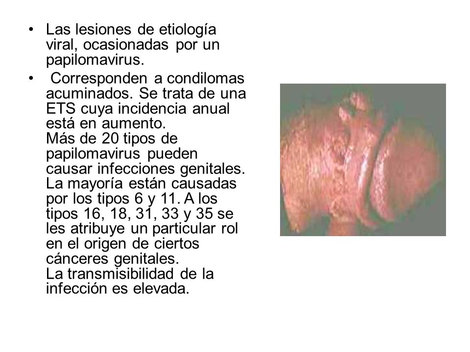 Las lesiones de etiología viral, ocasionadas por un papilomavirus.