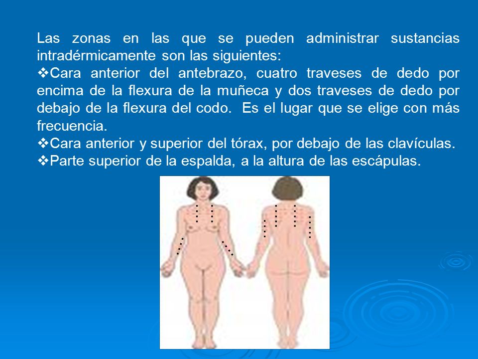 Las zonas en las que se pueden administrar sustancias intradérmicamente son las siguientes: