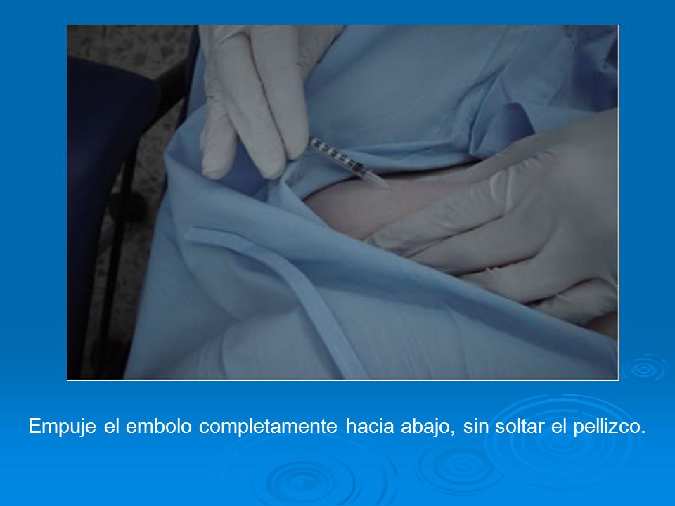 Empuje el embolo completamente hacia abajo, sin soltar el pellizco.