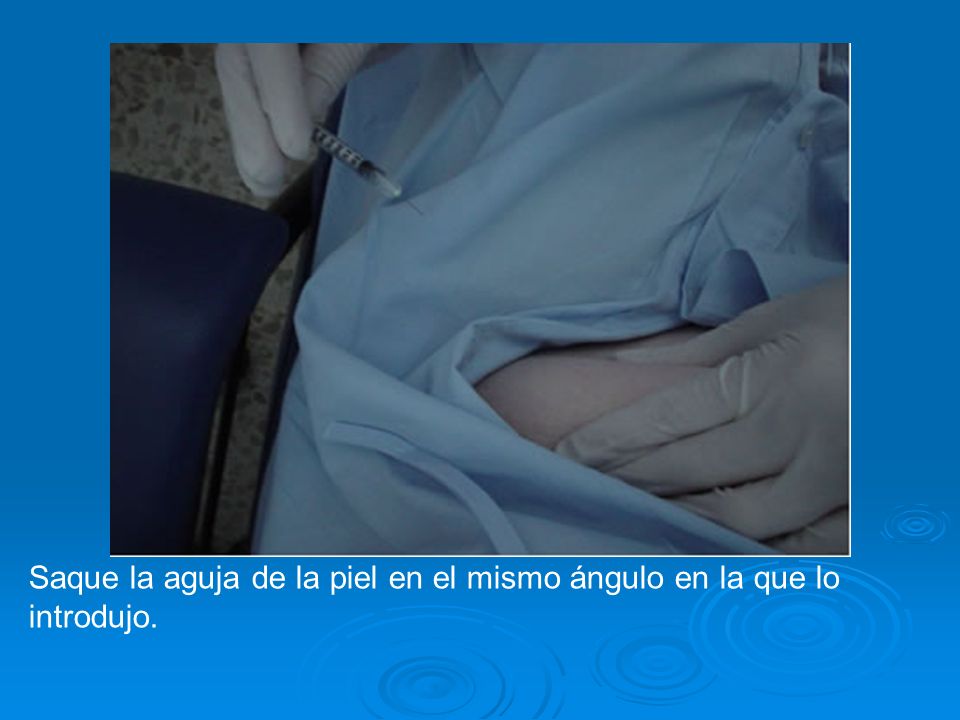 Saque la aguja de la piel en el mismo ángulo en la que lo introdujo.