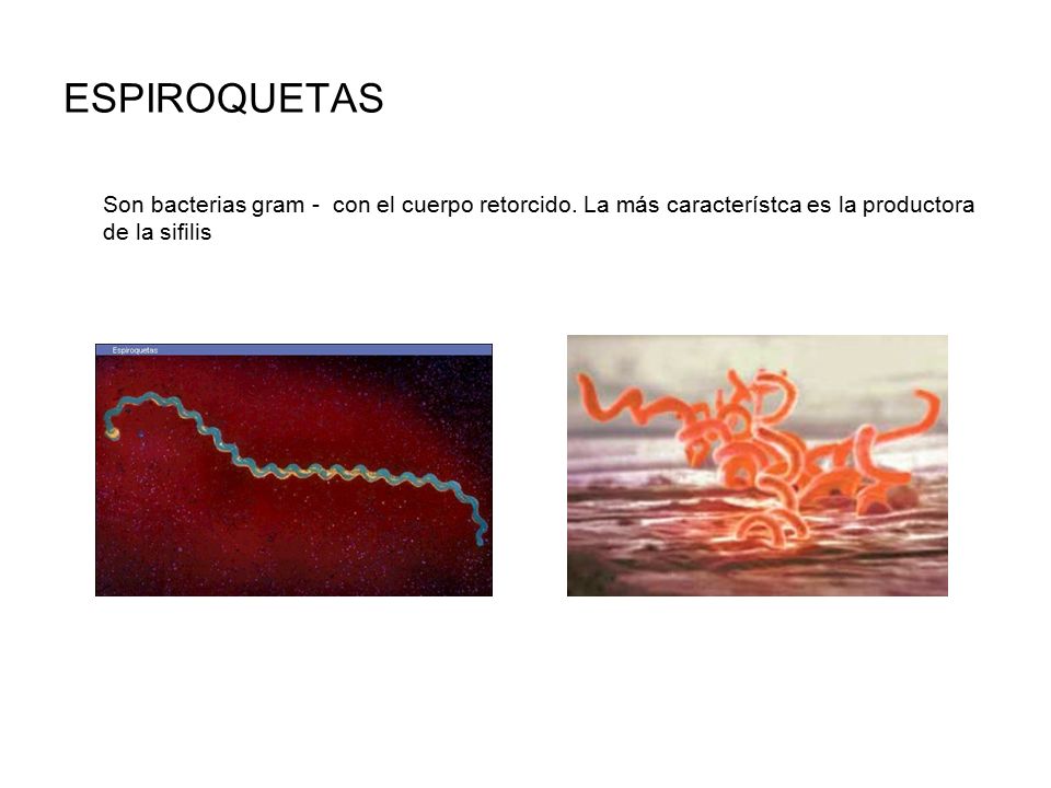 ESPIROQUETAS Son bacterias gram - con el cuerpo retorcido.