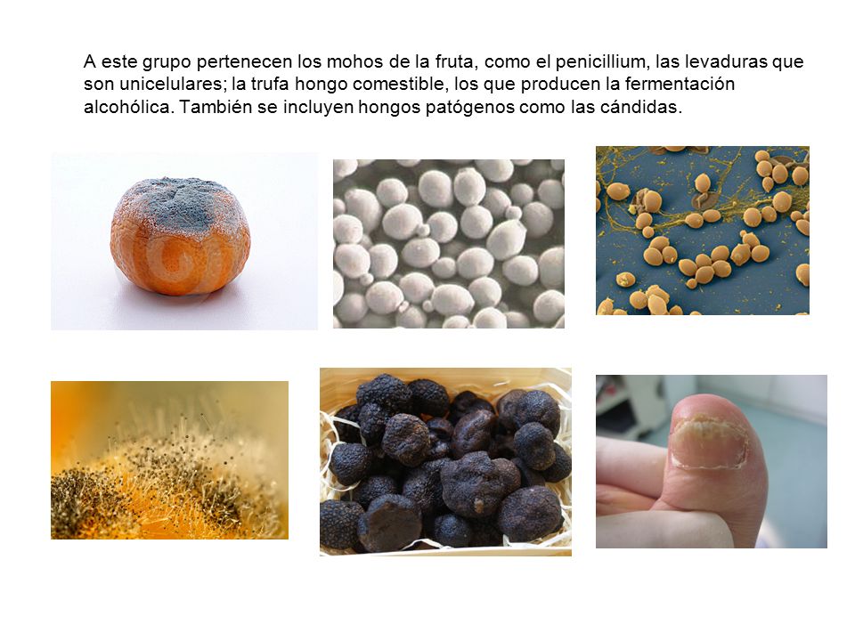 A este grupo pertenecen los mohos de la fruta, como el penicillium, las levaduras que son unicelulares; la trufa hongo comestible, los que producen la fermentación alcohólica.