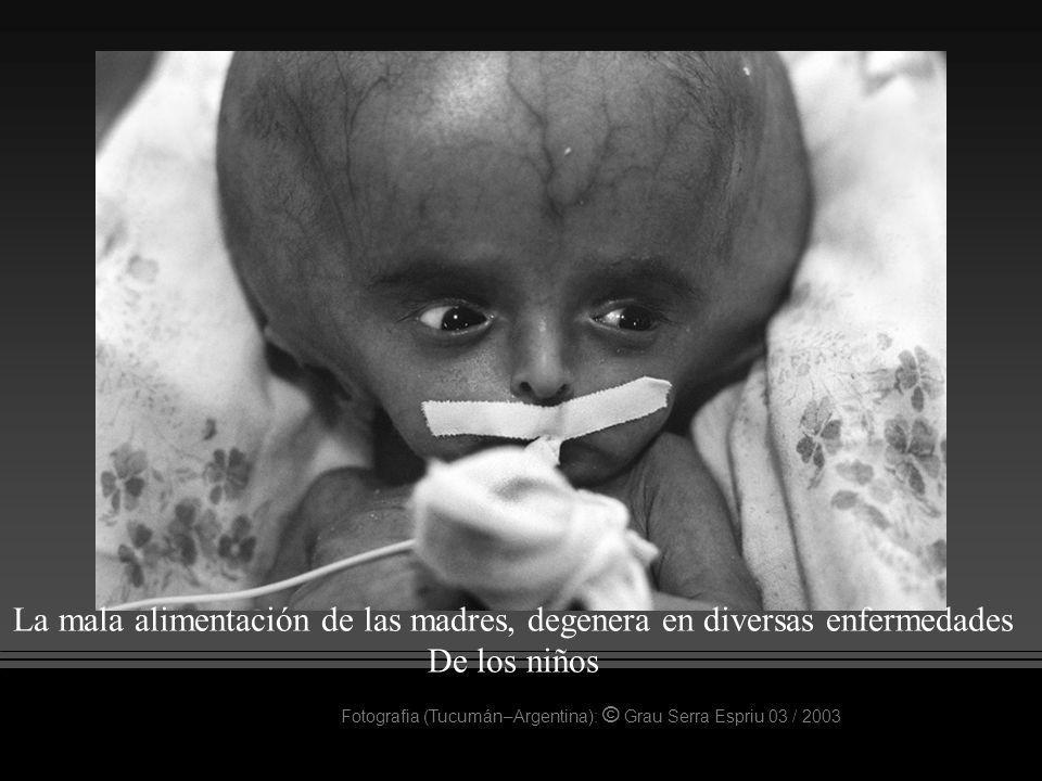 La mala alimentación de las madres, degenera en diversas enfermedades