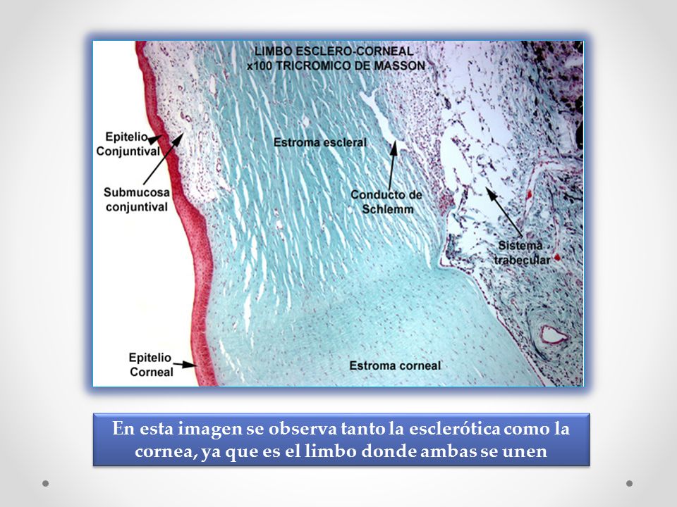 En esta imagen se observa tanto la esclerótica como la cornea, ya que es el limbo donde ambas se unen