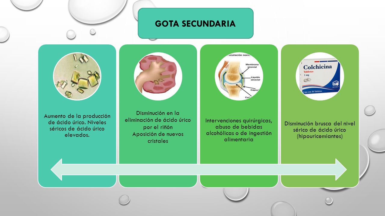 GOTA SECUNDARIA Aumento de la producción de ácido úrico. Niveles séricos de ácido úrico elevados.