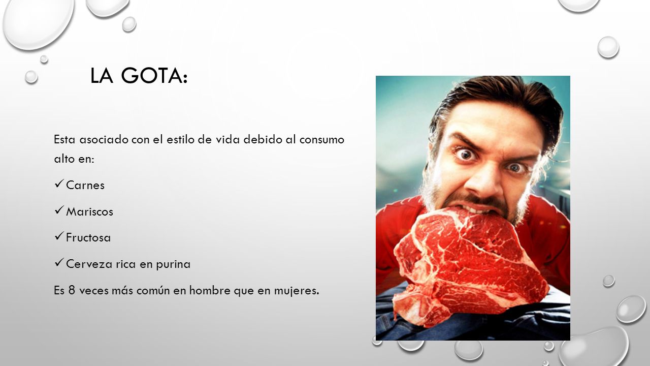 LA GOTA: Esta asociado con el estilo de vida debido al consumo alto en: Carnes. Mariscos. Fructosa.