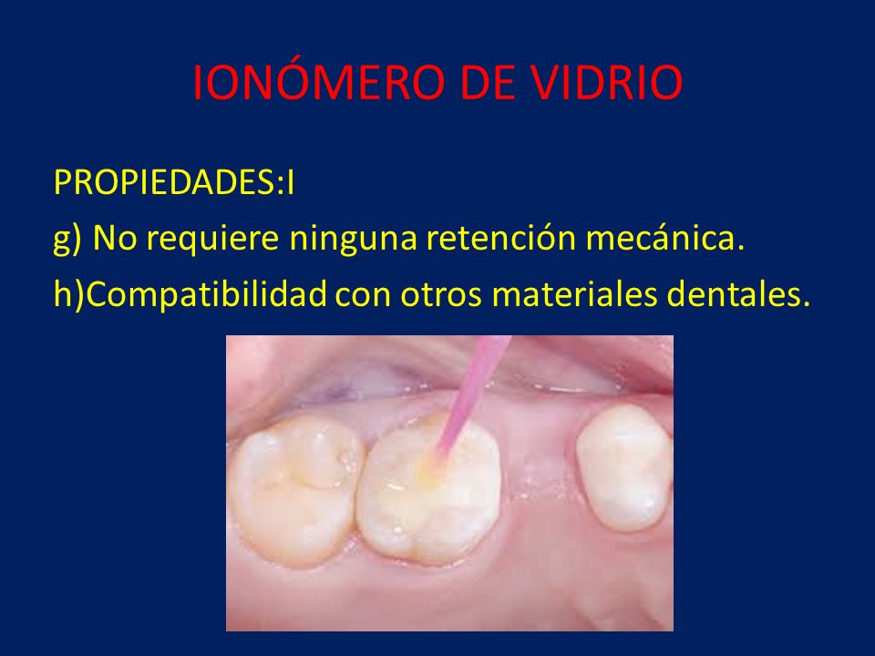IONÓMERO DE VIDRIO PROPIEDADES:I g) No requiere ninguna retención mecánica. h)Compatibilidad con otros materiales dentales.