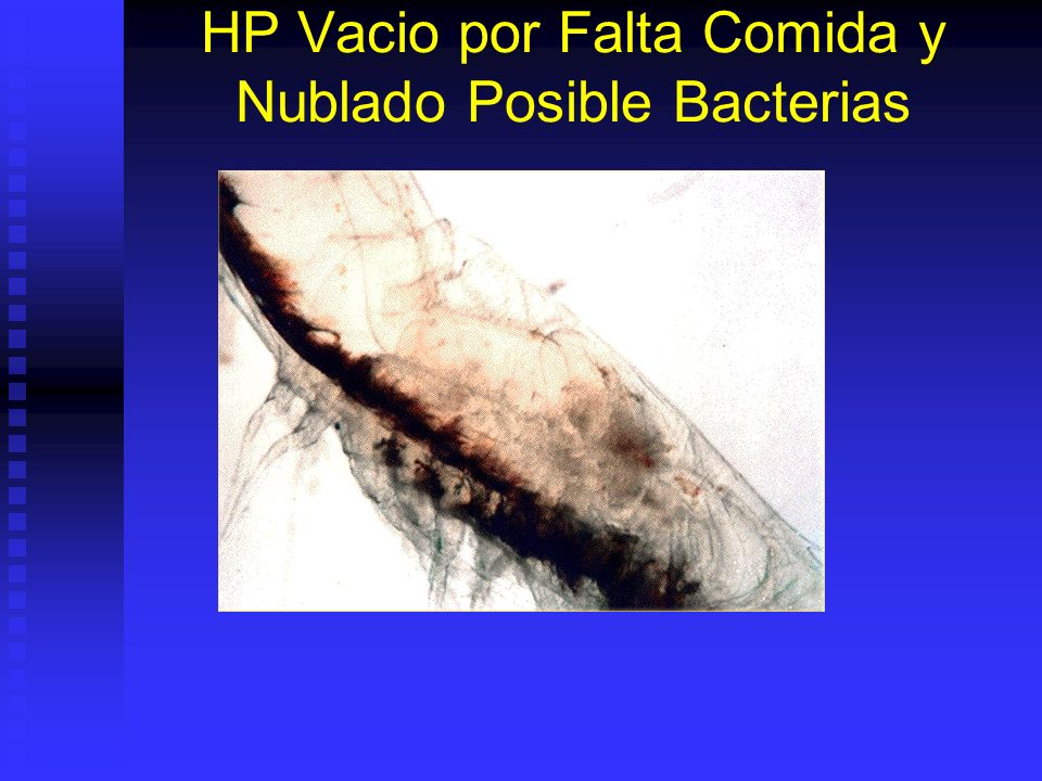 HP Vacio por Falta Comida y Nublado Posible Bacterias