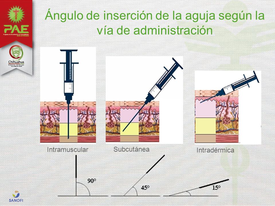 Ángulo de inserción de la aguja según la vía de administración